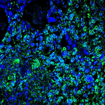 YBX2 Antibody