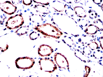 YBX2 Antibody
