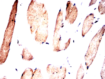 YBX2 Antibody