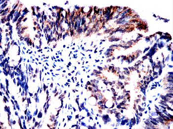 YBX2 Antibody