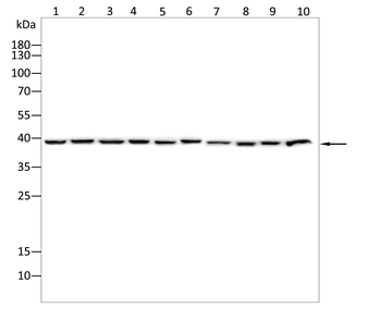 YBX2 Antibody