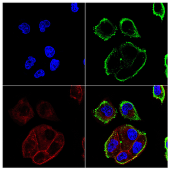 IL6ST Antibody