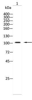 IL6ST Antibody