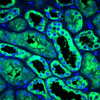LNPK Antibody