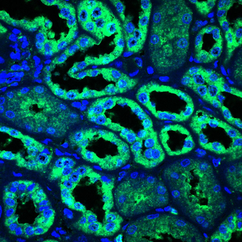 LNPK Antibody