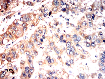 LNPK Antibody