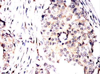 LNPK Antibody