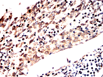 LNPK Antibody