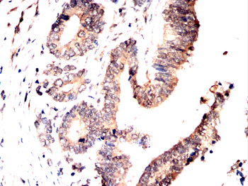 LNPK Antibody