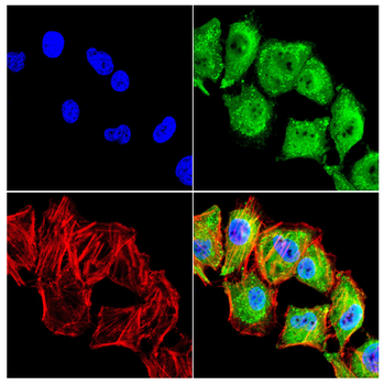 UAP1 Antibody