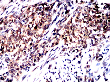 Il6 Antibody