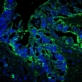 Il6 Antibody