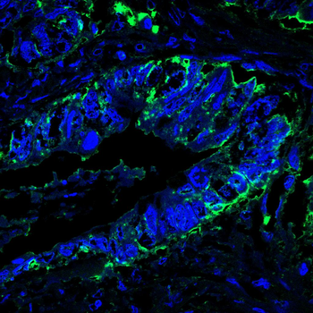 Il6 Antibody