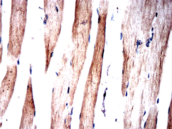 Il6 Antibody