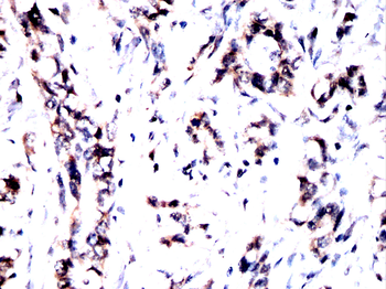 Il6 Antibody
