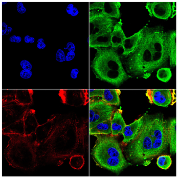 IL1R1 Antibody