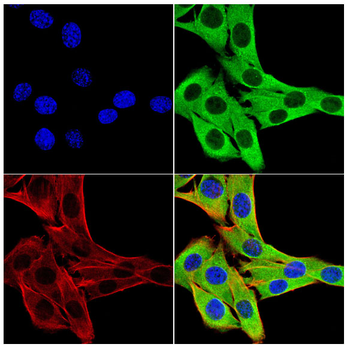 IL1R1 Antibody