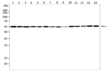 IL1R1 Antibody