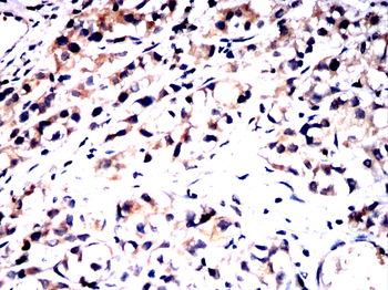 P2RX7 Antibody