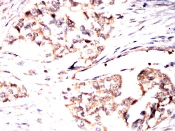 P2RX7 Antibody