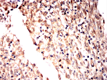 P2RX7 Antibody