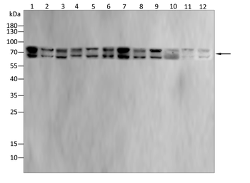 P2RX7 Antibody