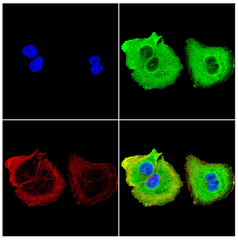 IGLC2 Antibody