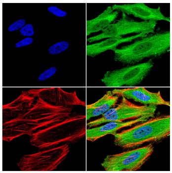 IGLC2 Antibody