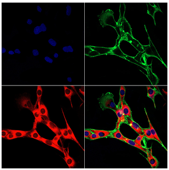 PDIA4 Antibody