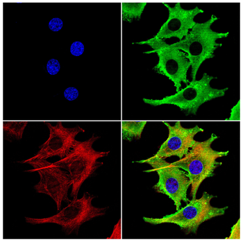 RAN Antibody