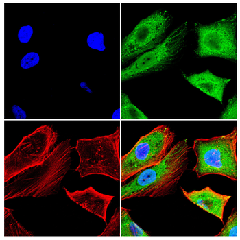 TSHB Antibody