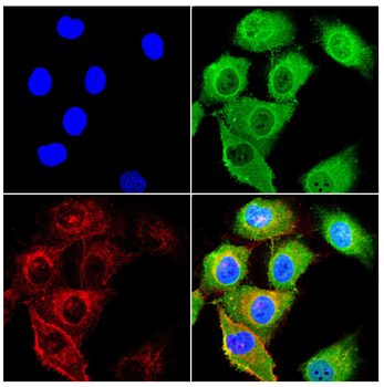 DDX3X Antibody