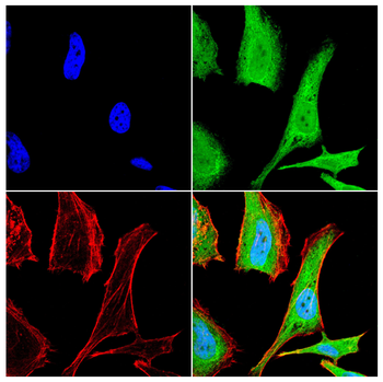DDX3X Antibody