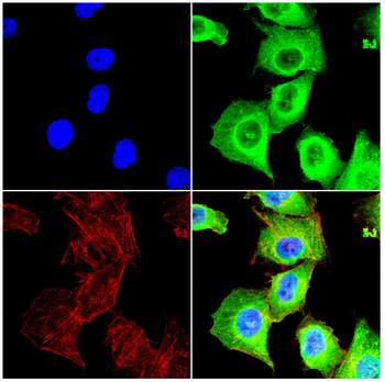 ULK2 Antibody
