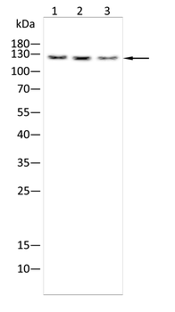 ULK2 Antibody