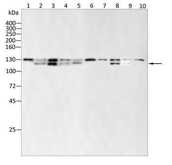 SMARCA1 Antibody