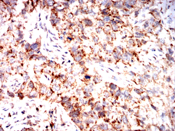 BCL2L10 Antibody