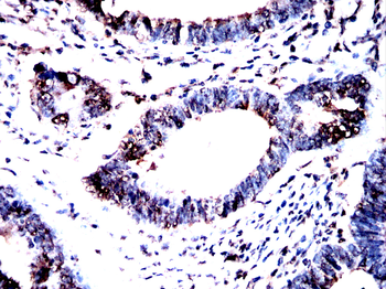 KHSRP Antibody
