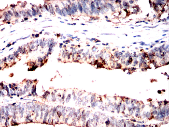 DDX20 Antibody