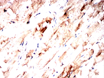 DDX20 Antibody