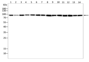 DDX20 Antibody