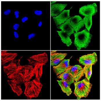 DDX20 Antibody