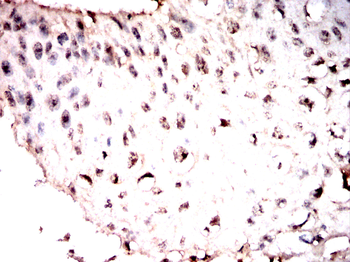 DDX20 Antibody