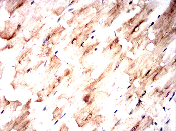 DDX20 Antibody