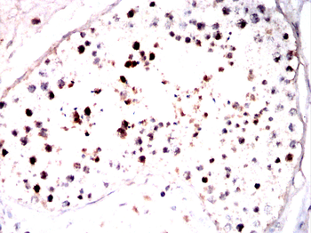 DDX20 Antibody