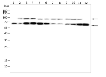 DDX20 Antibody