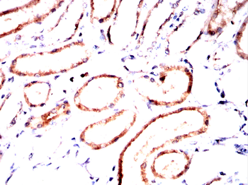 RALB Antibody