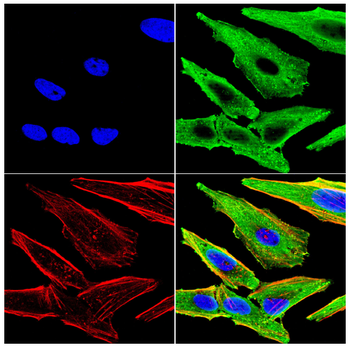 PTPN14 Antibody