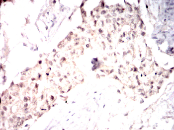 PTPN14 Antibody