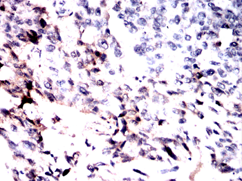 PTPN14 Antibody